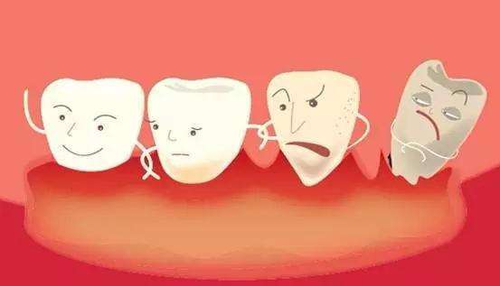 什么是急性坏死性龈炎 什么是急性坏死性龈炎?疾病表现及治疗方法